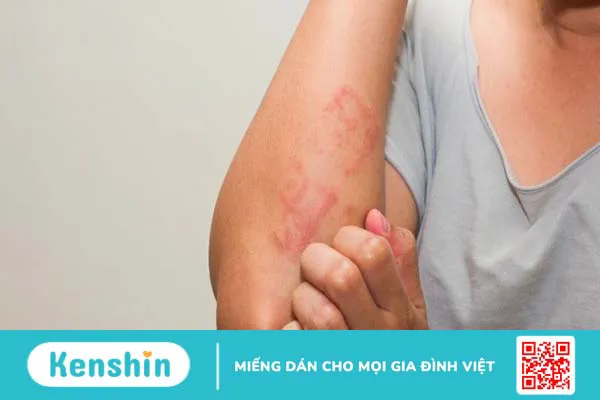 Cây đuôi chuột trị bệnh gì? 13 tác dụng và bài thuốc trị bệnh hiệu quả