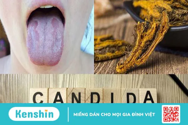 Cây hoàng liên có tác dụng gì? 16 bài thuốc đơn giản từ hoàng liên