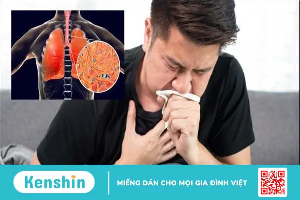 Cây hoàng liên có tác dụng gì? 16 bài thuốc đơn giản từ hoàng liên