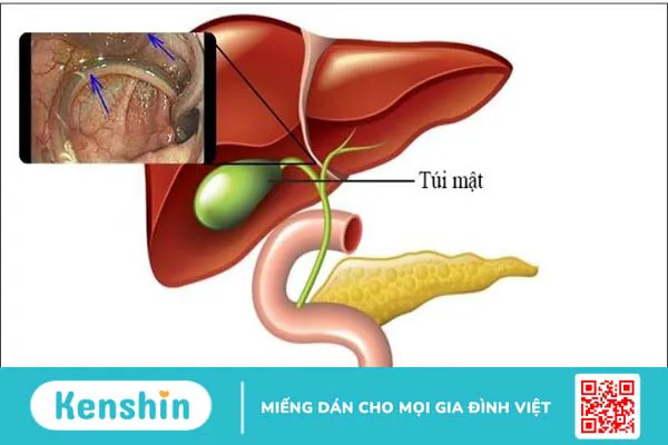 Cây hoàng liên có tác dụng gì? 16 bài thuốc đơn giản từ hoàng liên