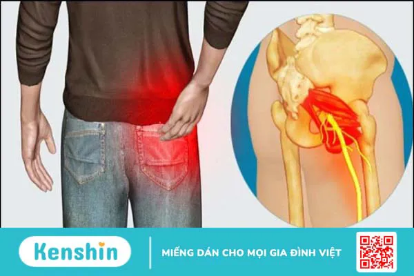 Cây kê huyết đằng có tác dụng gì? 12 vị thuốc kê huyết đằng hiệu quả