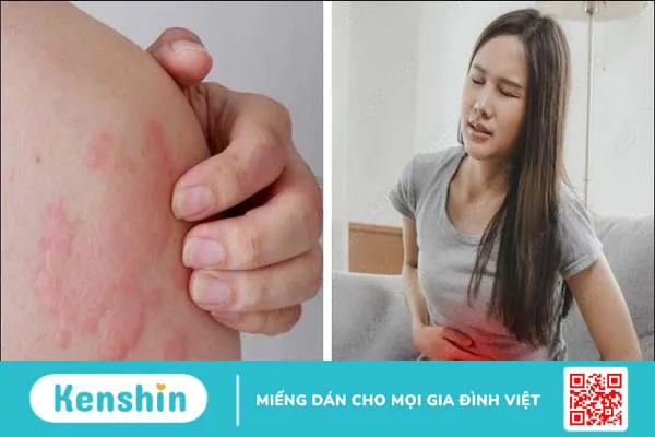 Cây lạc tiên có tác dụng gì? 7 tác dụng và bài thuốc từ lạc tiên