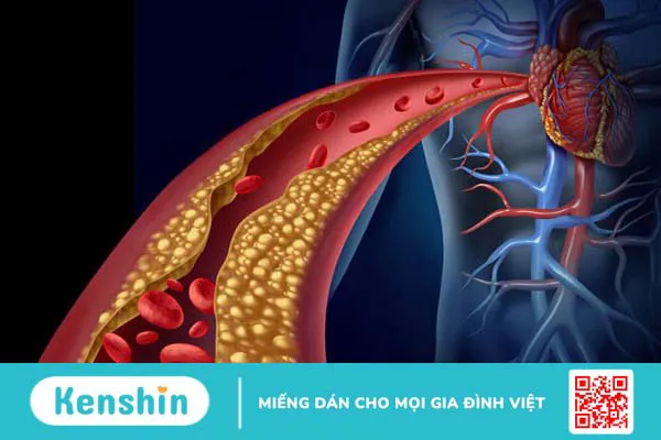 Cây mật gấu có tác dụng gì? 13 tác dụng của cây mật gấu bạn nên biết