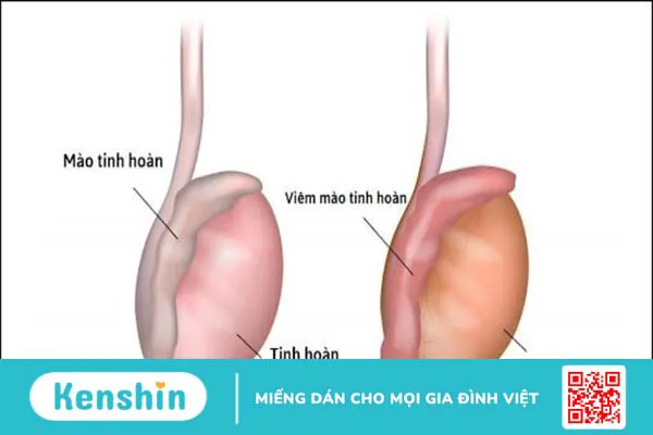 Cây ngũ gia bì có tác dụng gì? 14 bài thuốc từ cây ngũ gia bì