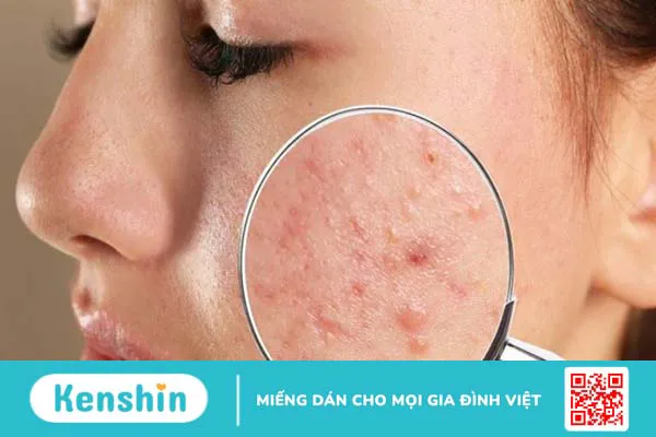 Cây nhân trần có tác dụng gì? 12 công dụng và các lưu ý khi uống