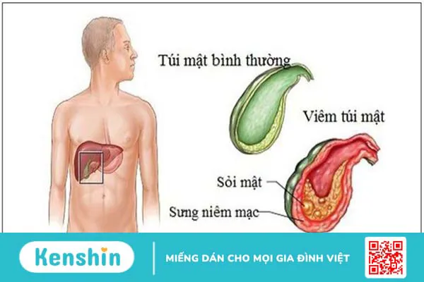 Cây nhân trần có tác dụng gì? 12 công dụng và các lưu ý khi uống