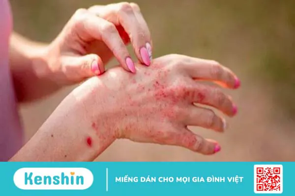 Cây sầu đâu là gì? 9 công dụng điều trị bệnh và lưu ý sử dụng