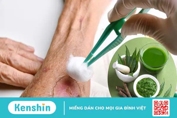 Cây sầu đâu là gì? 9 công dụng điều trị bệnh và lưu ý sử dụng