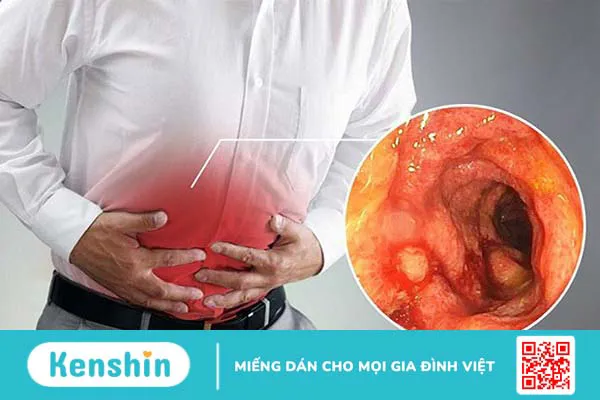 Cây vối có tác dụng gì? 9 công dụng của cây vối đối với sức khỏe