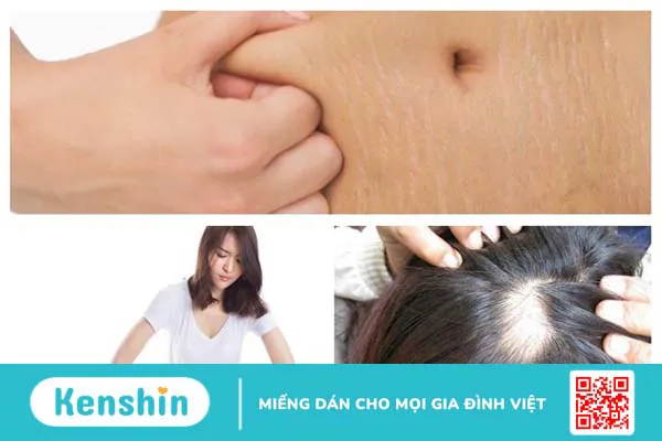 Chăm sóc bà mẹ trong thời kỳ hậu sản