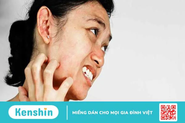 Chanh có tác dụng giảm mụn và sẹo mụn không?