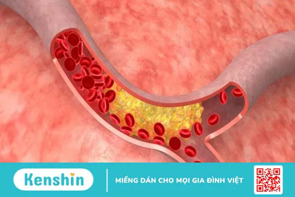 Chất xơ là gì, có mấy loại? Vai trò của chất xơ đối với cơ thể