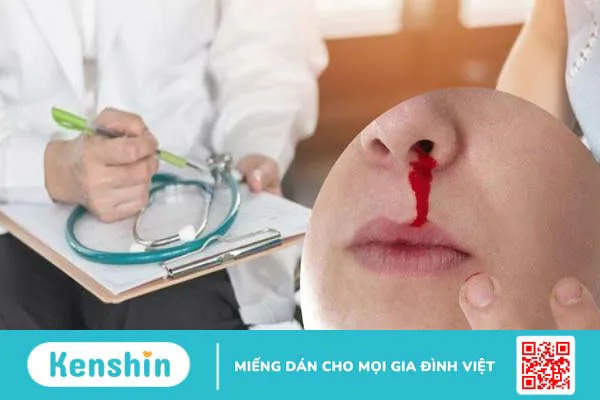 Chảy máu cam có nguy hiểm không? Cách xử lý và phòng ngừa hiệu quả