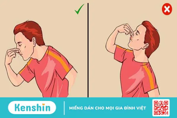 Chảy máu cam có nguy hiểm không? Cách xử lý và phòng ngừa hiệu quả