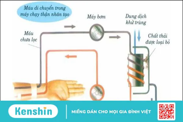 Chạy thận nhân tạo là gì? Quy trình, lợi ích và cách chăm sóc hiệu quả