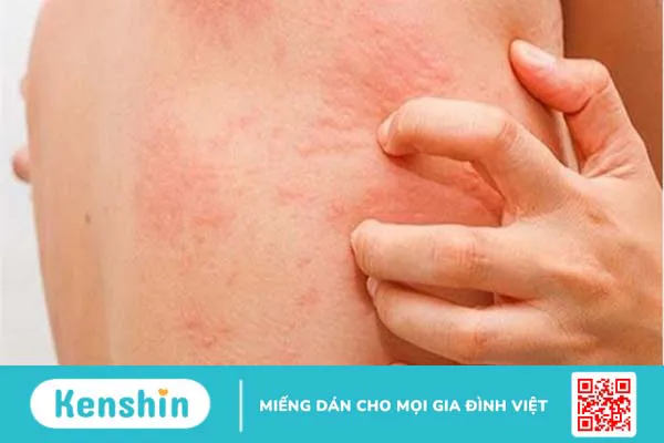 Chạy thận nhân tạo là gì? Quy trình, lợi ích và cách chăm sóc hiệu quả