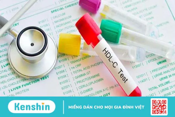 Chỉ số HDL là gì? Chỉ số HDL-cholesterol trong máu cao có ý nghĩa gì?