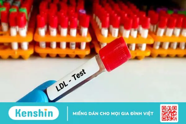 Chỉ số LDL-C trong máu là gì? LDL bình thường là bao nhiêu?