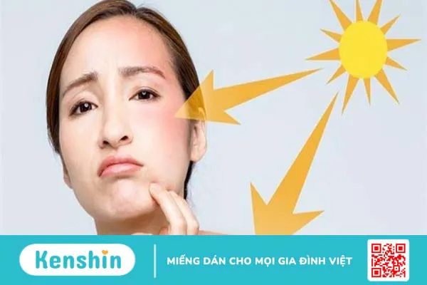 Chỉ số SPF bao nhiêu là tốt? Cách chọn kem chống nắng tốt cho làn da