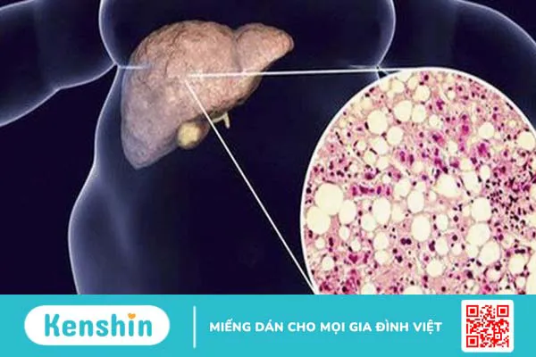 Choline là gì? 10 tác dụng của choline đối với cơ thể bạn cần biết