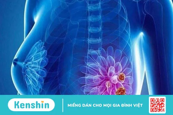 Choline là gì? 10 tác dụng của choline đối với cơ thể bạn cần biết