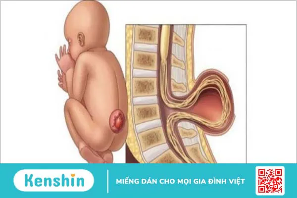 Choline là gì? 10 tác dụng của choline đối với cơ thể bạn cần biết