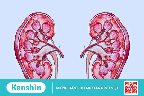 Chôm chôm có tác dụng gì? 17 tác dụng của chôm chôm và lưu ý khi ăn