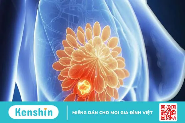 Chôm chôm có tác dụng gì? 17 tác dụng của chôm chôm và lưu ý khi ăn