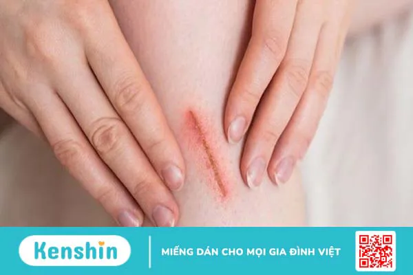 Chôm chôm có tác dụng gì? 17 tác dụng của chôm chôm và lưu ý khi ăn