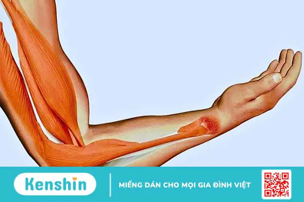 Chôm chôm có tác dụng gì? 17 tác dụng của chôm chôm và lưu ý khi ăn