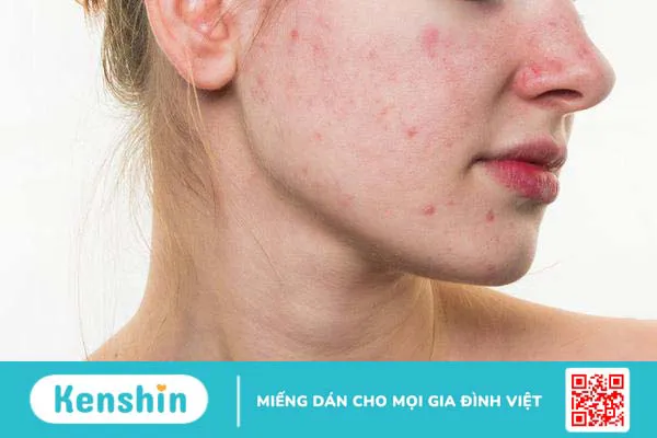 Chuyện gì sẽ xảy ra với sức khỏe nếu bạn không uống đủ nước mỗi ngày?