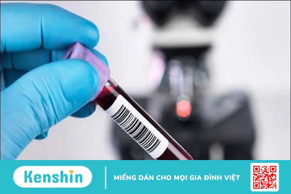 Có nên đi khám hậu Covid-19 không? Khám ở đâu tốt? Gói khám gồm những gì?