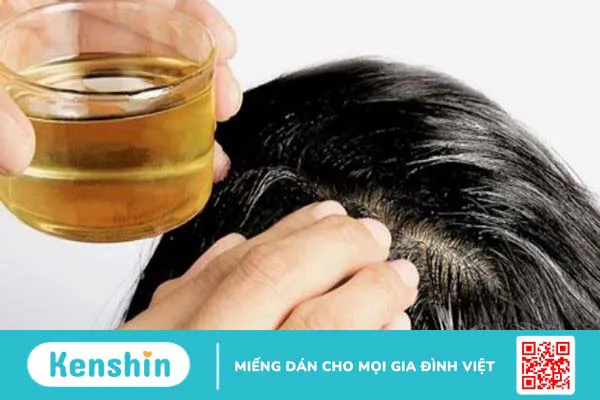 Có nên sử dụng giấm táo điều trị eczema không?