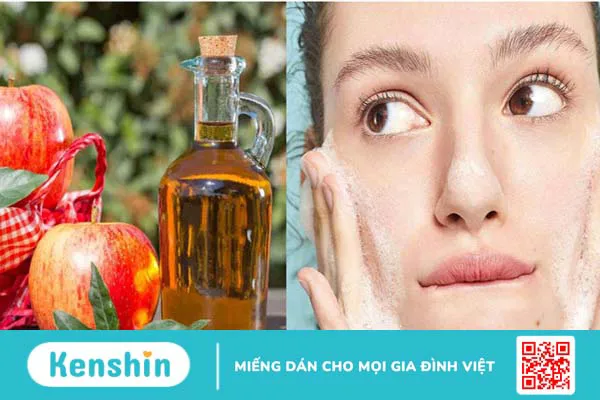 Có nên sử dụng giấm táo trị mụn không?