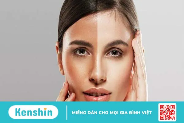 Có nên sử dụng Glutathione để làm trắng da và ngăn ngừa lão hoá không?