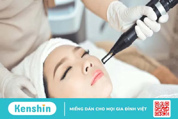 Có nên tẩy nốt ruồi tại nhà? Lưu ý và cách tẩy nốt ruồi an toàn