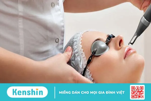 Có nên tẩy nốt ruồi tại nhà? Lưu ý và cách tẩy nốt ruồi an toàn