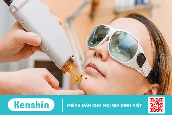 Có nên tẩy nốt ruồi tại nhà? Lưu ý và cách tẩy nốt ruồi an toàn