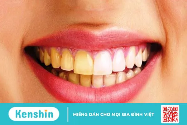 Cỏ ngọt là gì? 8 tác dụng của cỏ ngọt đối với sức khoẻ bạn nên biết