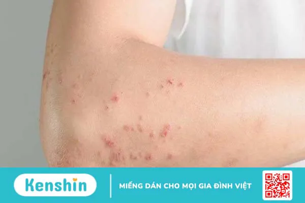 Cỏ ngọt là gì? 8 tác dụng của cỏ ngọt đối với sức khoẻ bạn nên biết