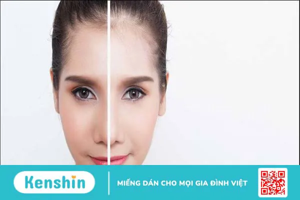 Collagen có tác dụng gì cho da? 10 loại collagen bán chạy tại Kenshin