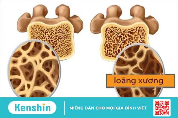 Collagen là gì? 10 tác dụng của collagen đối với sức khỏe bạn nên biết