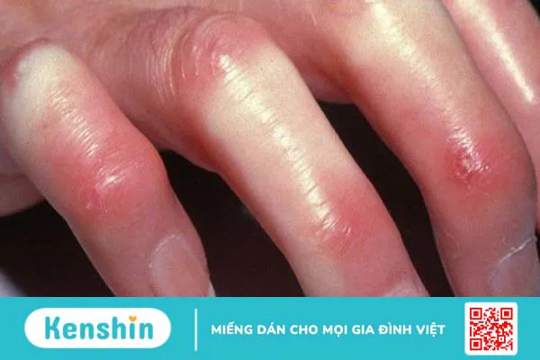 Collagen là gì? 10 tác dụng của collagen đối với sức khỏe bạn nên biết