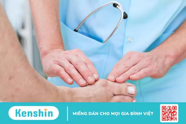 Củ bình vôi có tác dụng gì? Xem ngay 5 lợi ích sức khỏe sau