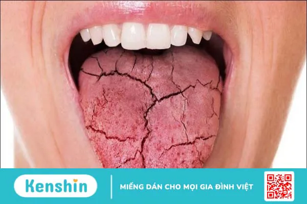 Đắng miệng là bệnh gì? 14 nguyên nhân điển hình của đắng miệng