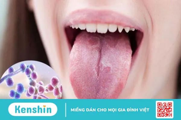 Đắng miệng là bệnh gì? 14 nguyên nhân điển hình của đắng miệng