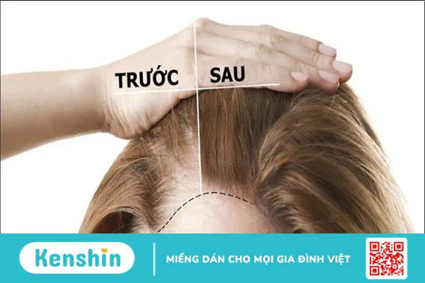 Dầu cà rốt có thật sự tốt cho tóc không?