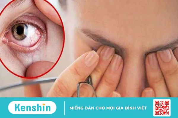 Dầu hạt lanh có thật sự tốt cho mắt không?