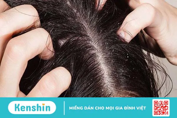 Dầu hạt lanh có thể chăm sóc tóc không?