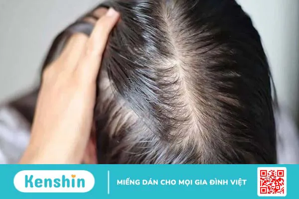 Dầu hạt lanh có thể chăm sóc tóc không?